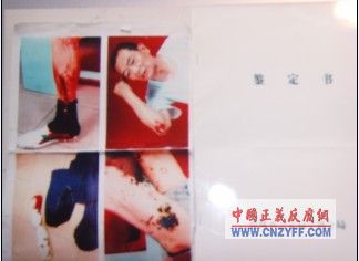 一人反腐、全家遭殃、诛连九族、报复成灾