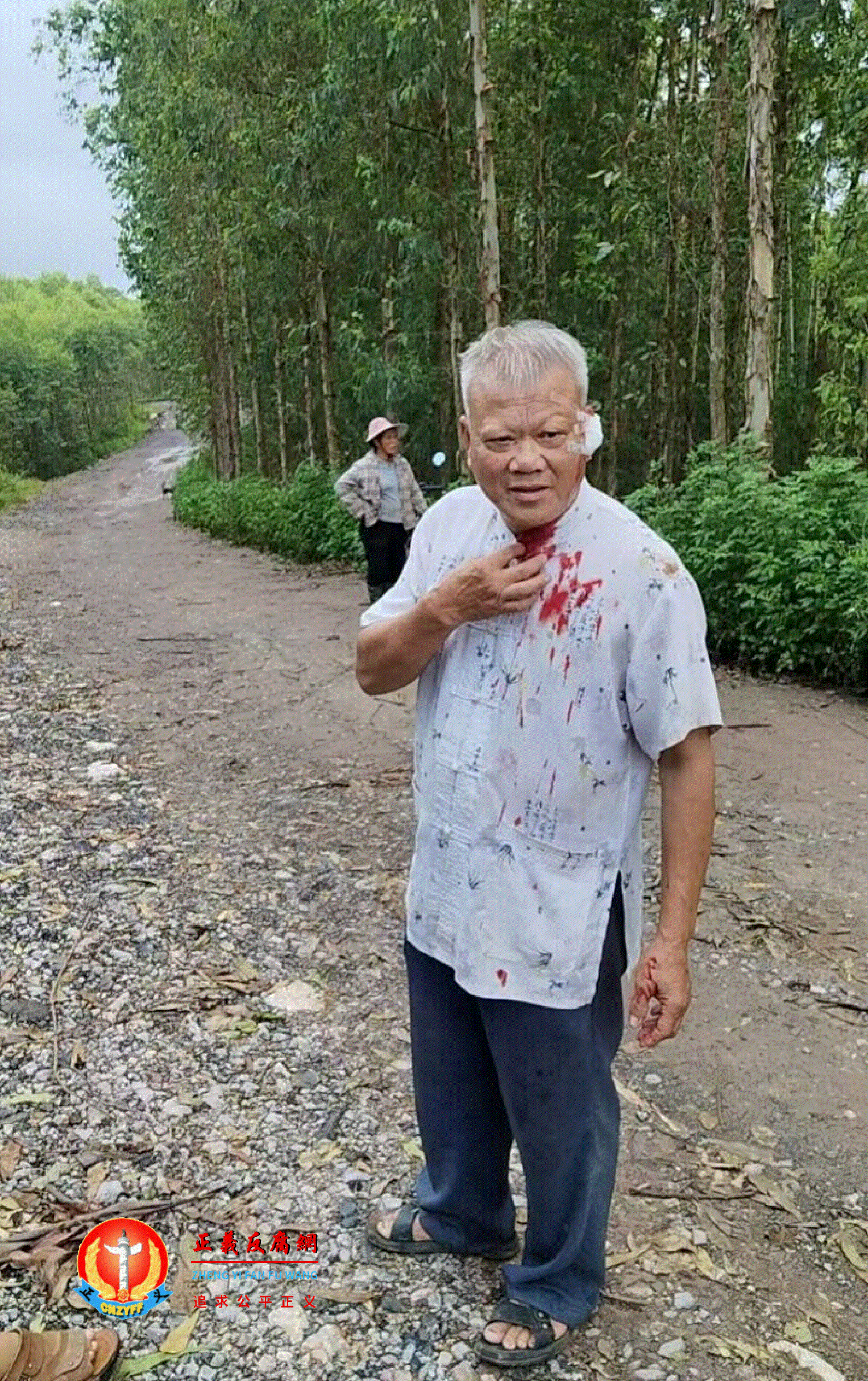 广西南宁市邕宁区百济镇华达村受伤村民。.gif